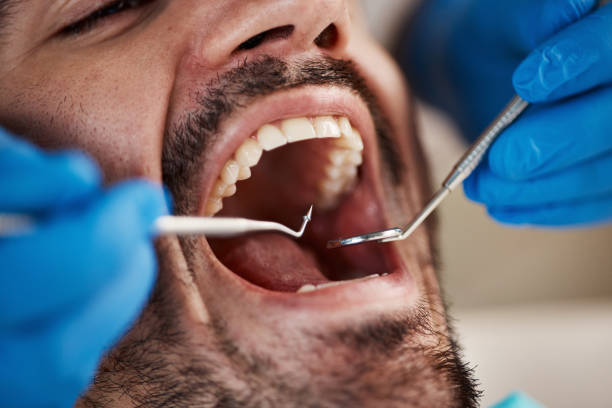 Best Broken Tooth Emergency  in Upper Grand Lagoon, FL